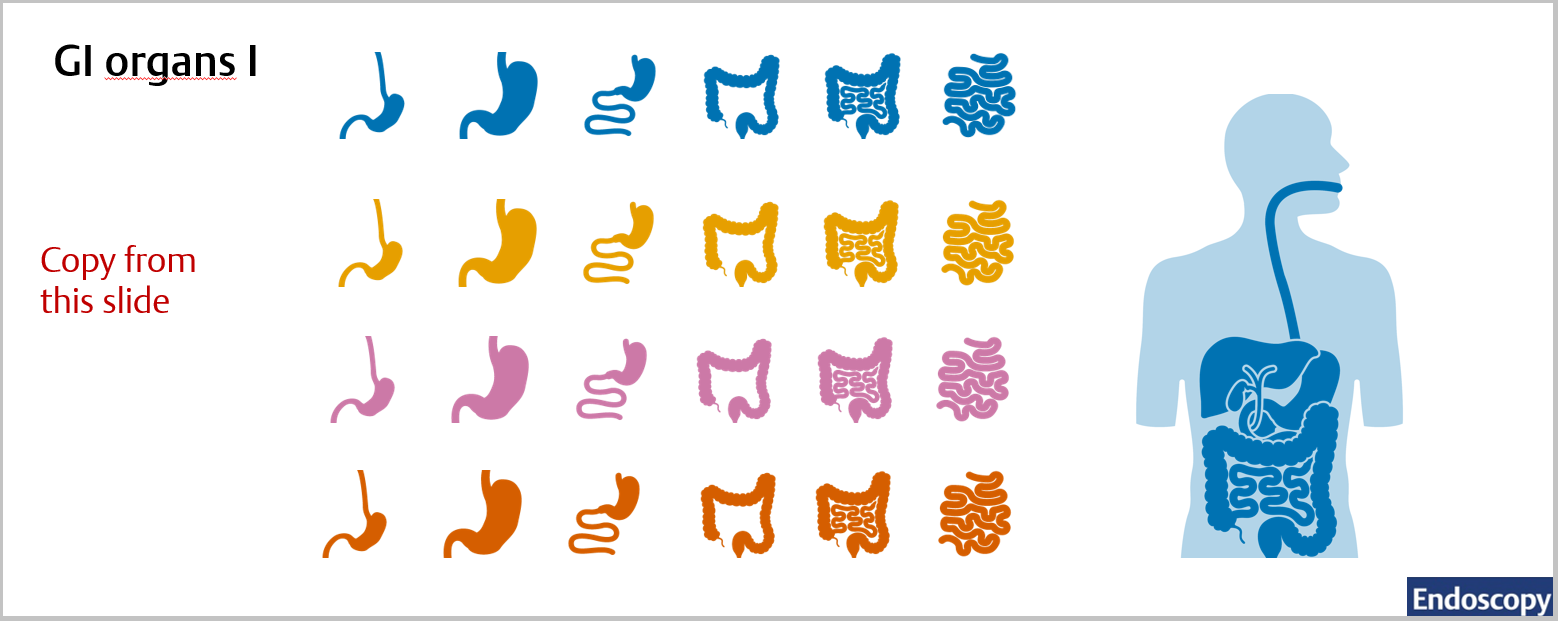 Endoscopy Graphical Abstracts Thieme Endoscopy