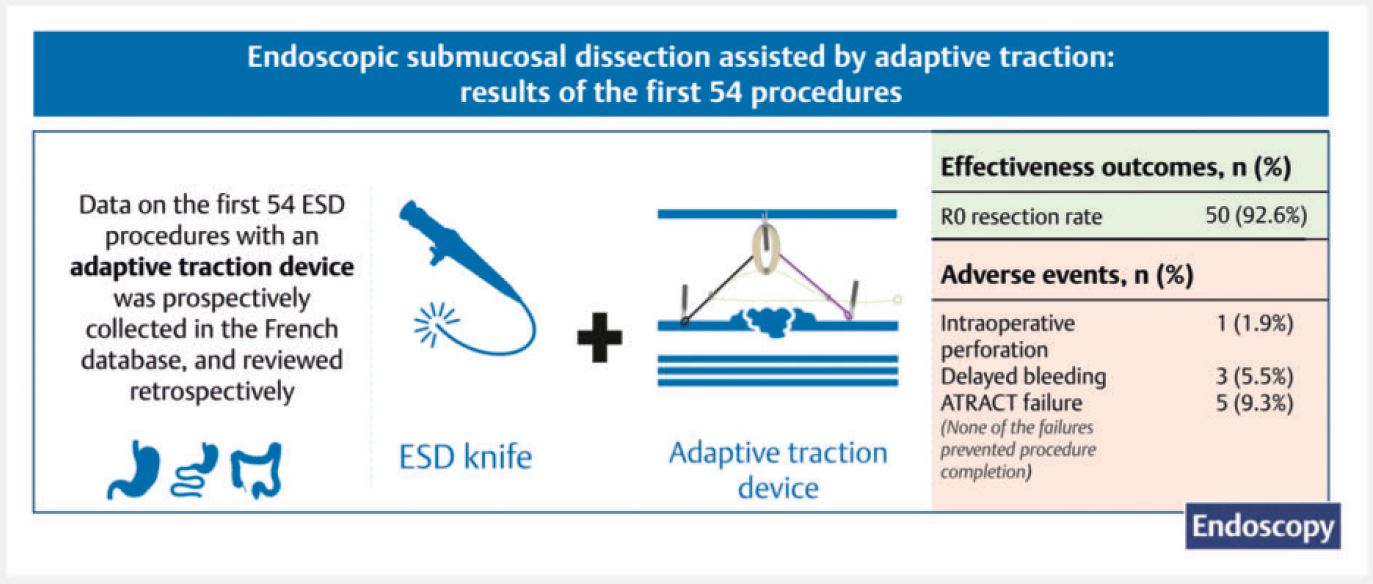 Image Gallery Thieme Endoscopy